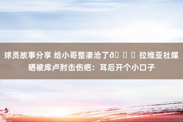 球员故事分享 给小哥整凄沧了😅拉维亚社媒晒被库卢肘击伤疤：耳后开个小口子